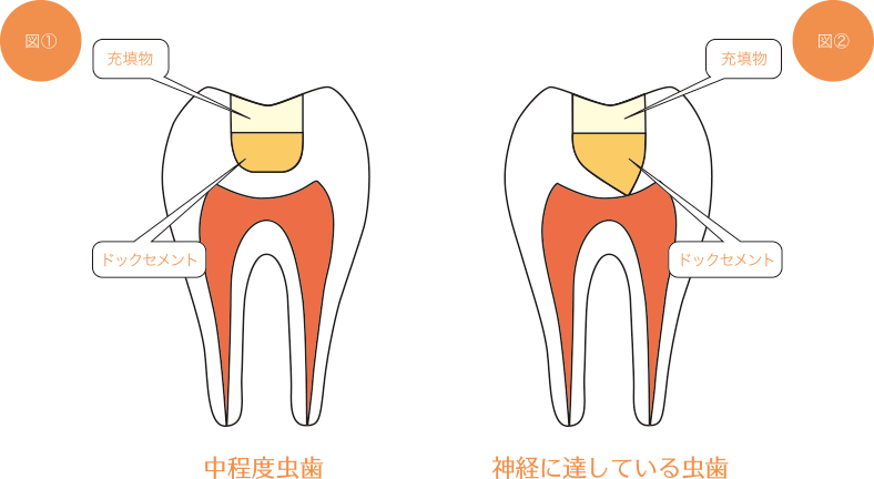 ドックベストセメント イメージ